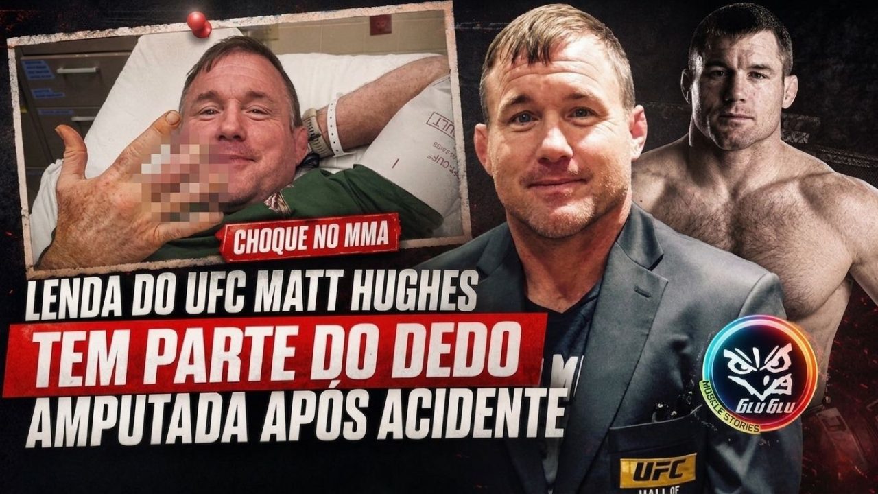 Imagem forte: lenda do UFC Matt Hughes tem parte do dedo amputada após acidente.